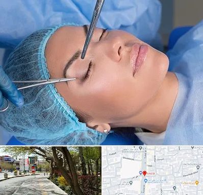 جراحی لیفت ابرو در خیابان توحید اصفهان