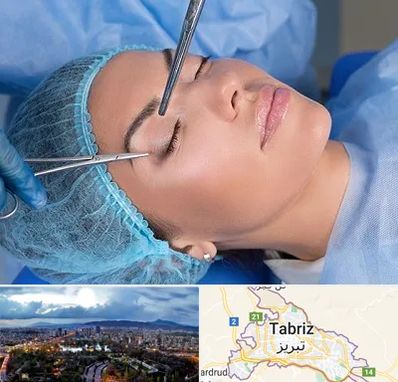 جراحی لیفت ابرو در تبریز