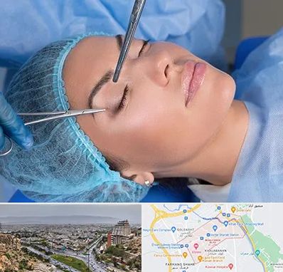 جراحی لیفت ابرو در معالی آباد شیراز