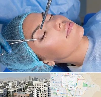 جراحی لیفت ابرو در منطقه 14 تهران 