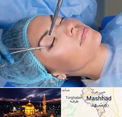 جراحی لیفت ابرو در مشهد