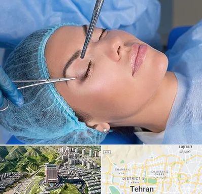 جراحی لیفت ابرو در شمال تهران 