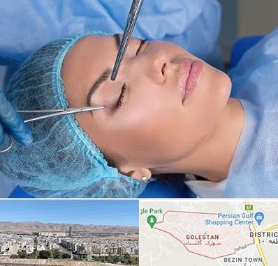 جراحی لیفت ابرو در شهرک گلستان شیراز