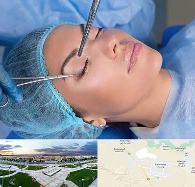 جراحی لیفت ابرو در بهارستان اصفهان