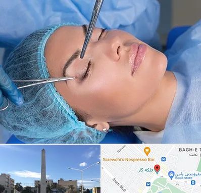 جراحی لیفت ابرو در فلکه گاز شیراز