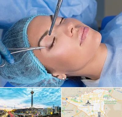 جراحی لیفت ابرو در تهران