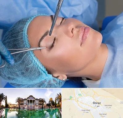 جراحی لیفت ابرو در شیراز