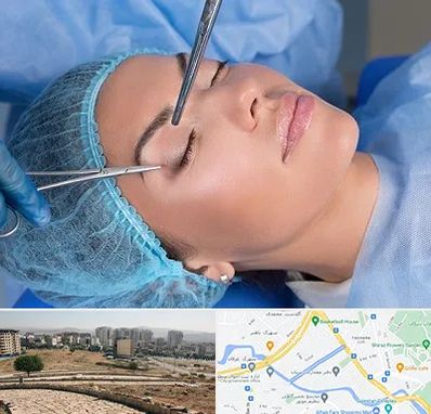 جراحی لیفت ابرو در کوی وحدت شیراز