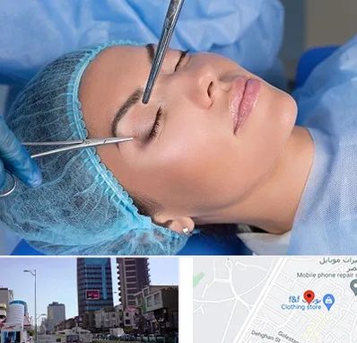 جراحی لیفت ابرو در چهارراه طالقانی کرج