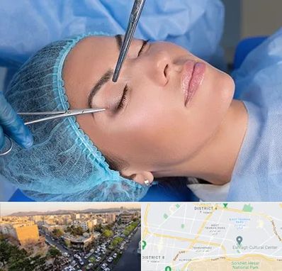جراحی لیفت ابرو در تهرانپارس 