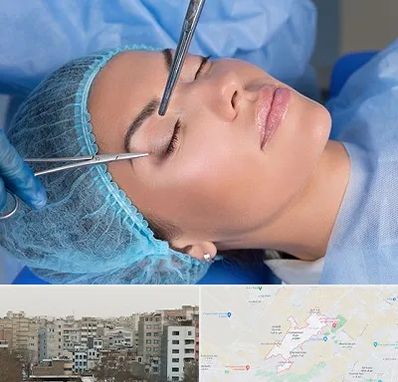 جراحی لیفت ابرو در محمد شهر کرج