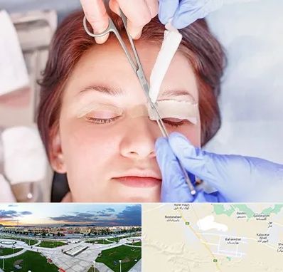 جراحی پلک افتاده در بهارستان اصفهان
