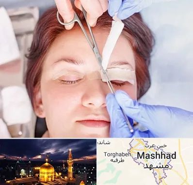 جراحی پلک افتاده در مشهد