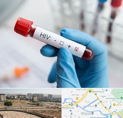 آزمایشگاه ایدز در کوی وحدت شیراز