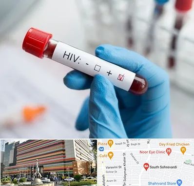 آزمایشگاه ایدز در سهروردی 