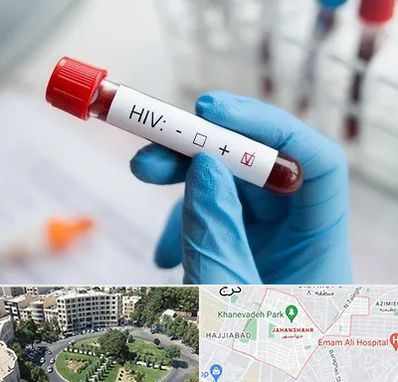 آزمایشگاه ایدز در جهانشهر کرج 