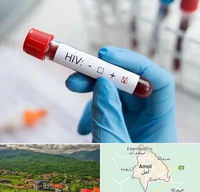 آزمایشگاه ایدز در آمل