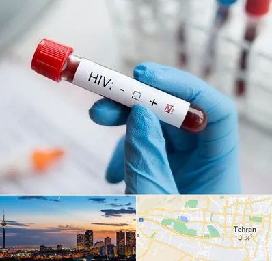 آزمایشگاه ایدز در غرب تهران 