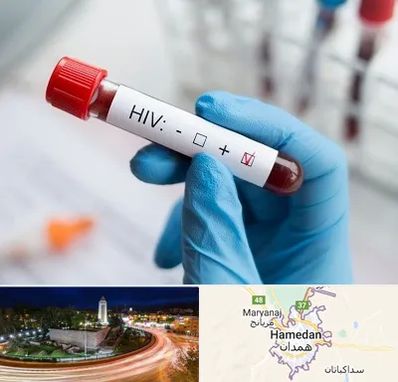 آزمایشگاه ایدز در همدان