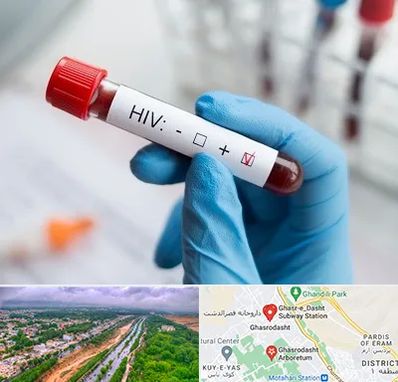 آزمایشگاه ایدز در قصرالدشت شیراز