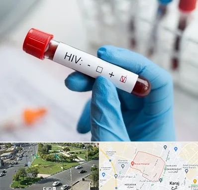 آزمایشگاه ایدز در شاهین ویلا کرج