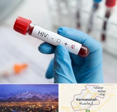 آزمایشگاه ایدز در کرمانشاه