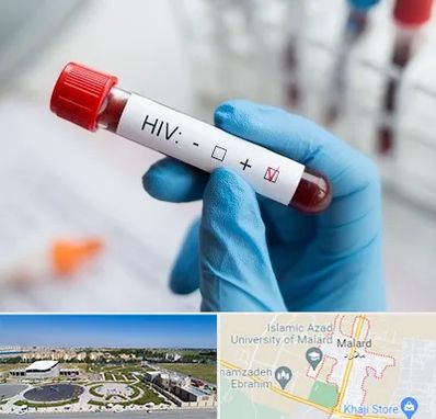 آزمایشگاه ایدز در ملارد