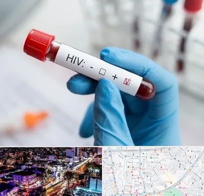 آزمایشگاه ایدز در منظریه رشت