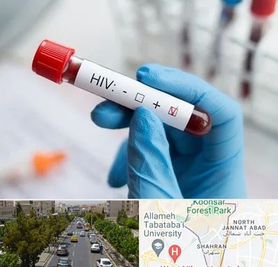 آزمایشگاه ایدز در شهران 