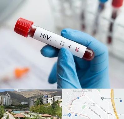 آزمایشگاه ایدز در شهر زیبا 