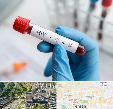 آزمایشگاه ایدز در شمال تهران 