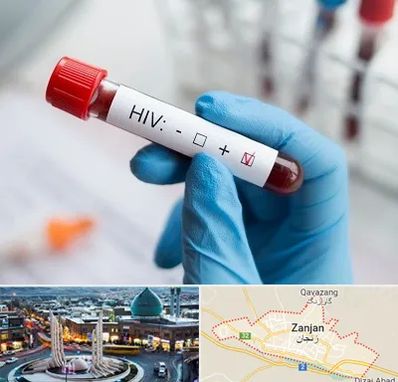 آزمایشگاه ایدز در زنجان