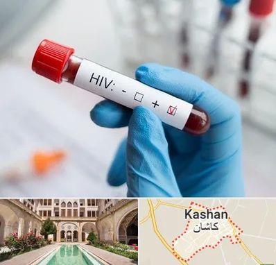 آزمایشگاه ایدز در کاشان