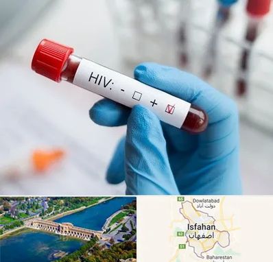 آزمایشگاه ایدز در اصفهان