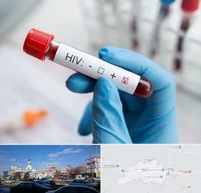 آزمایشگاه ایدز در ماهدشت کرج
