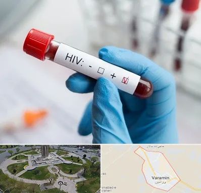 آزمایشگاه ایدز در ورامین