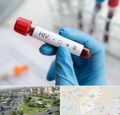 آزمایشگاه ایدز در کمال شهر کرج