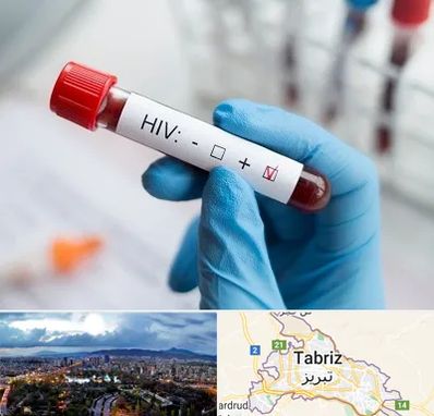 آزمایشگاه ایدز در تبریز
