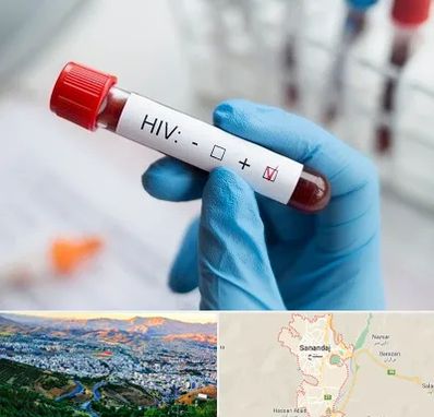 آزمایشگاه ایدز در سنندج