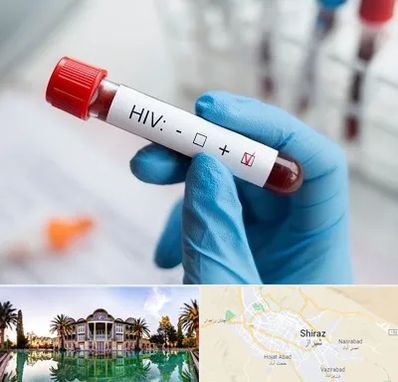 آزمایشگاه ایدز در شیراز