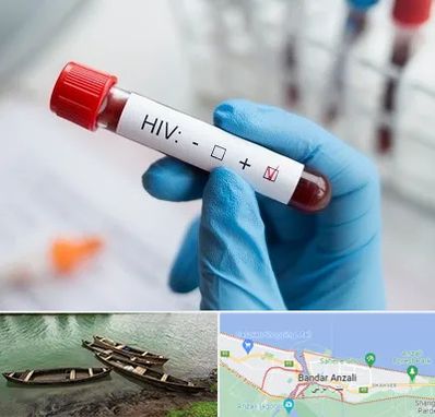 آزمایشگاه ایدز در بندر انزلی