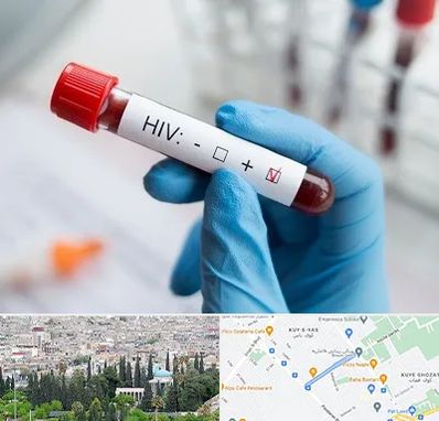 آزمایشگاه ایدز در محلاتی شیراز
