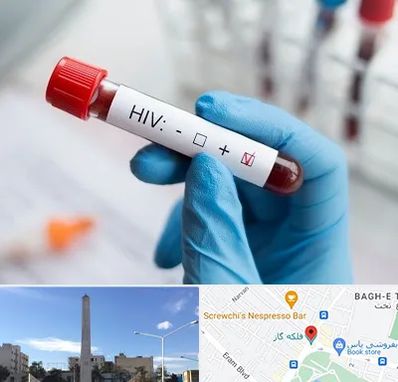 آزمایشگاه ایدز در فلکه گاز شیراز