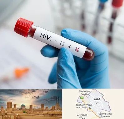 آزمایشگاه ایدز در یزد