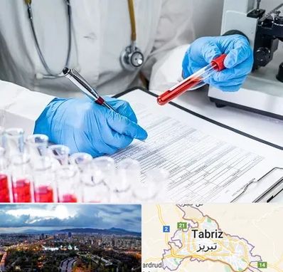 آزمایشگاه اعتیاد در تبریز