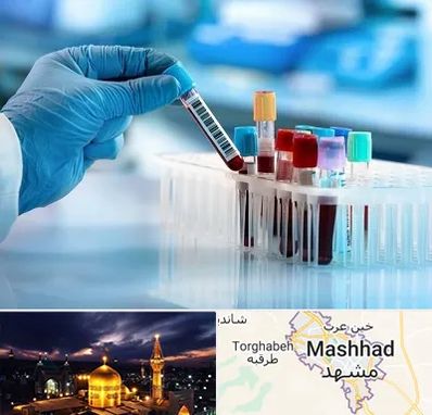 آزمایشگاه خون قبل از ازدواج در مشهد