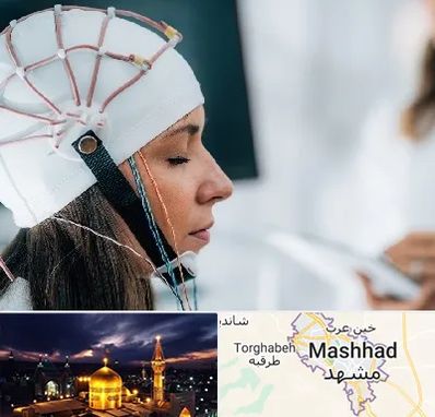 آزمایشگاه نقشه برداری مغز در مشهد