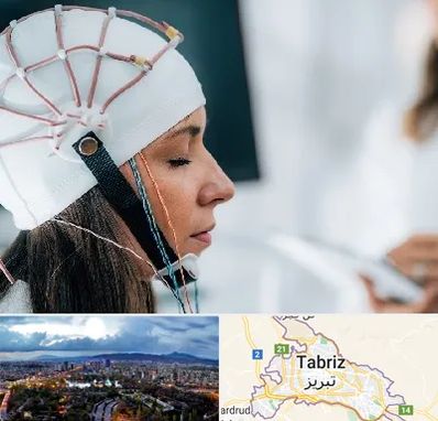 آزمایشگاه نقشه برداری مغز در تبریز