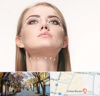 لیفت صورت با نخ در تربیت تبریز
