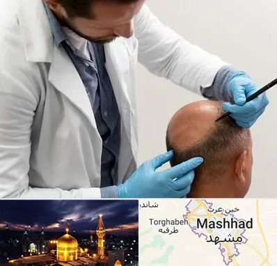 کاشت مو به روش تکثیری در مشهد